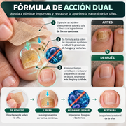PACK COMPLETO 80 PARCHES